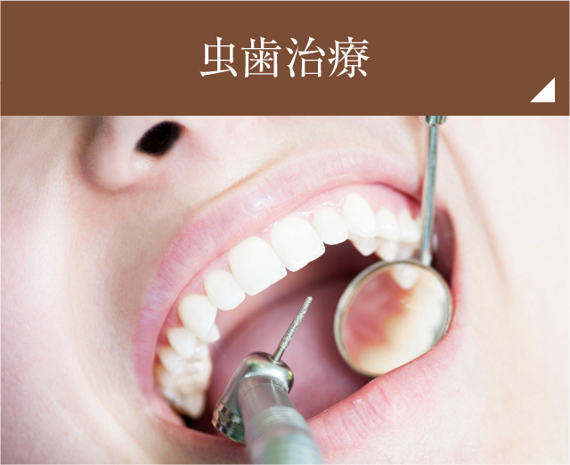 虫歯治療