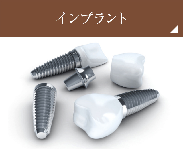 インプラント