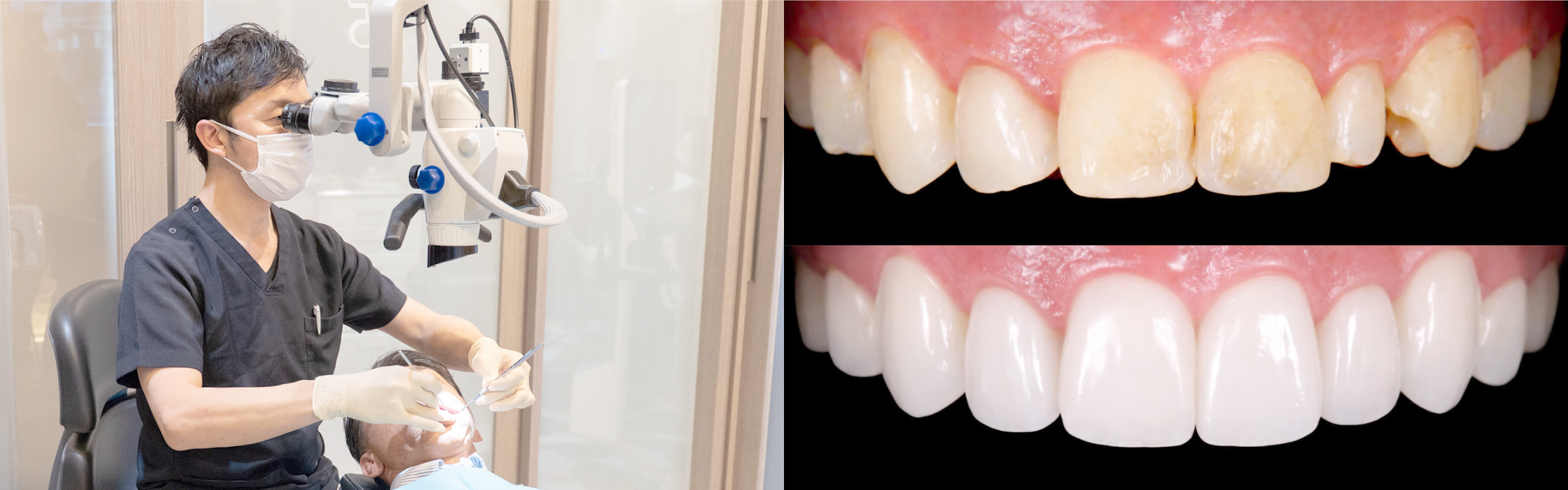 Treatment Menu 治療メニュー