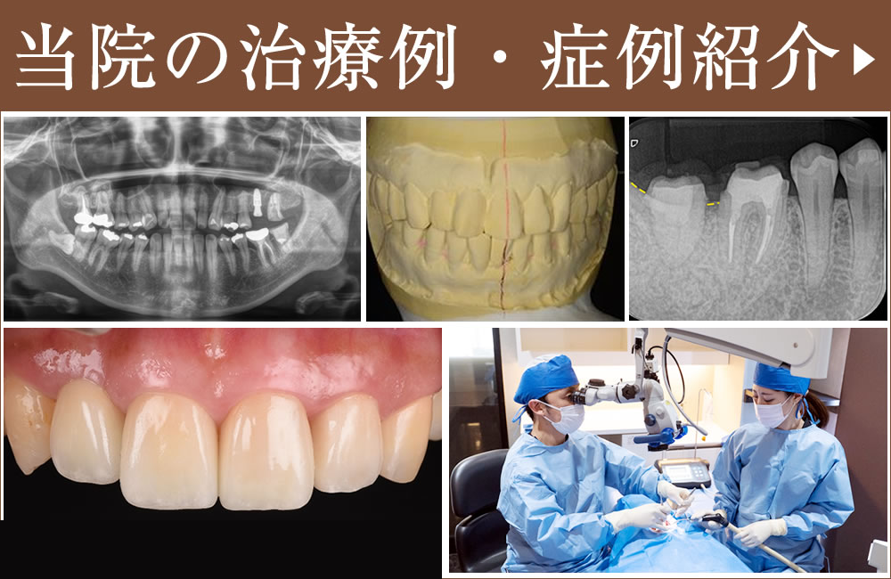 症例・治療例