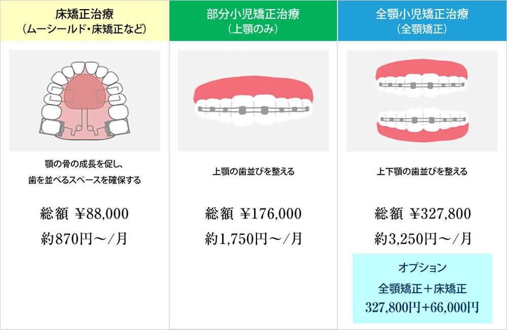 小児矯正治療プラン