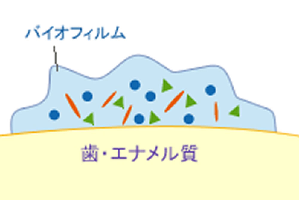 歯の定期クリーニング