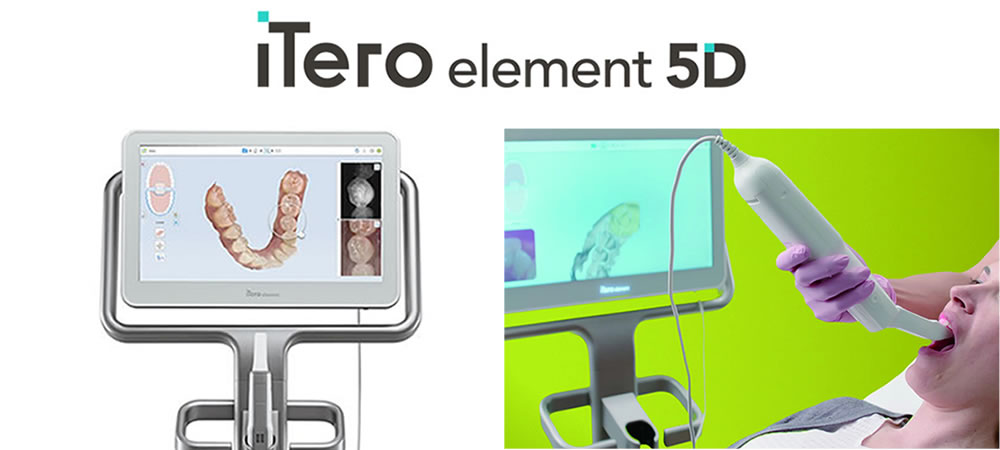 3D光学スキャナーiTero エレメント5Dplus