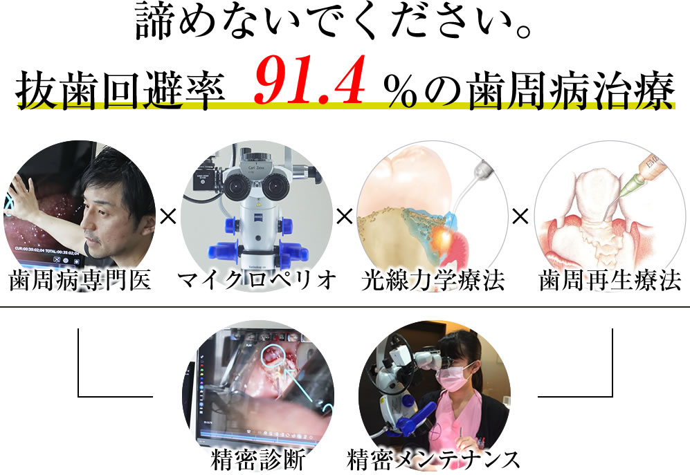 歯周病専門医・名医による抜歯回避率91.4％の歯周病治療