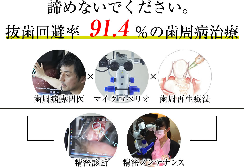 歯周病専門医・名医による抜歯回避率91.4％の歯周病治療